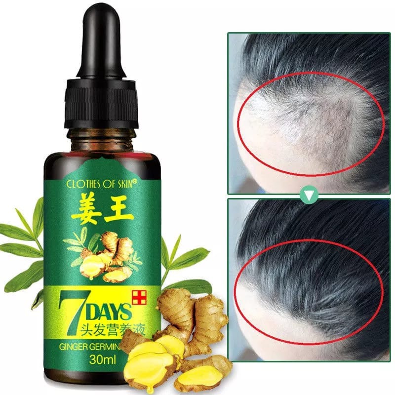 7 Days spray Hair Growth