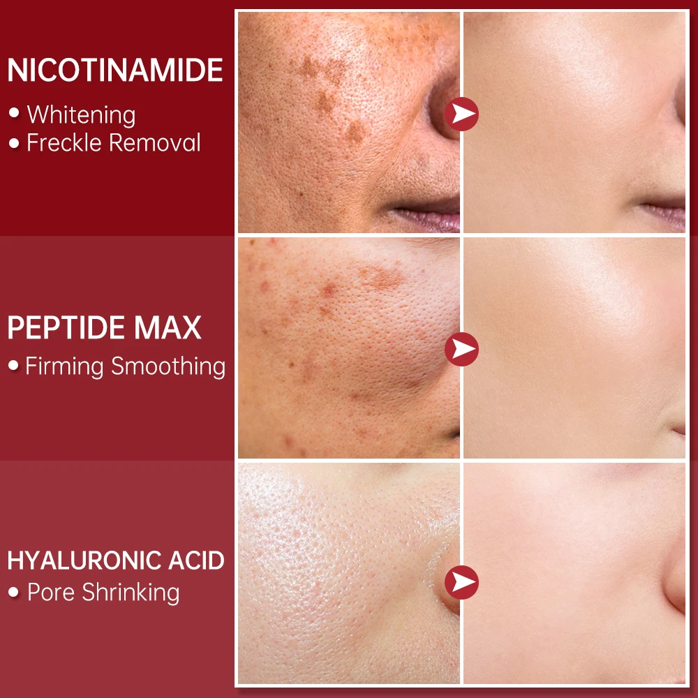 FORT PORE REFINING Serum Niacinamide & Glycolic