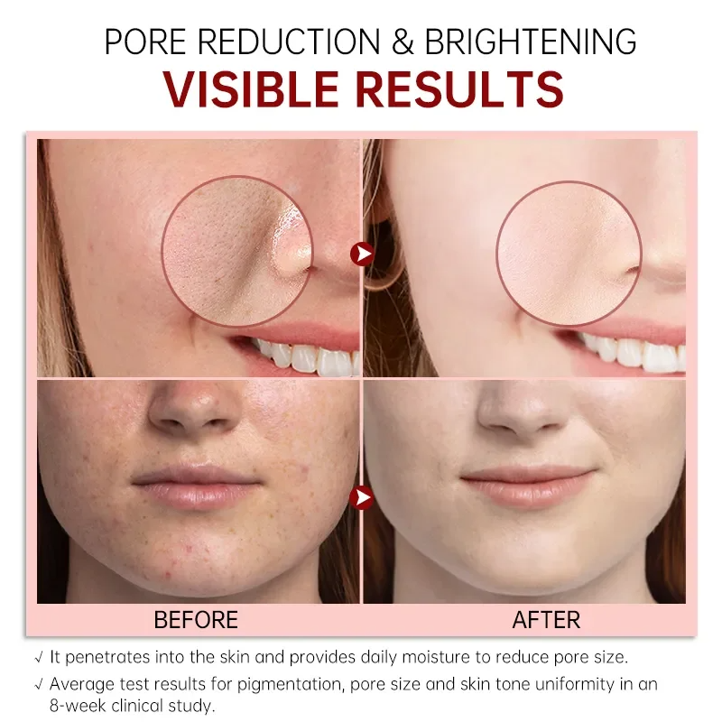 FORT PORE REFINING Serum Niacinamide & Glycolic